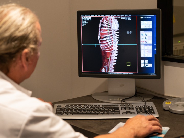 Hoe werkt het maken van een CT-scan?